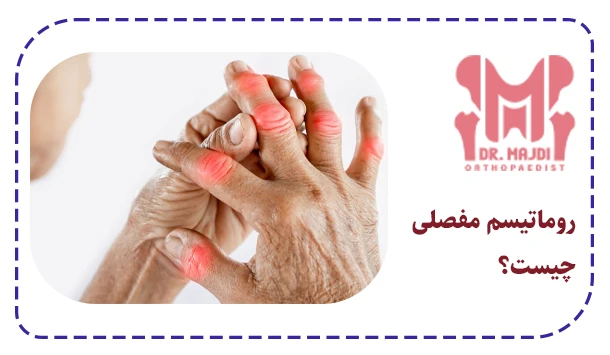 روماتیسم مفصلی چیست؟