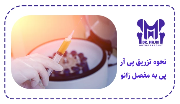نحوه تزریق پی آر پی به مفصل زانو
