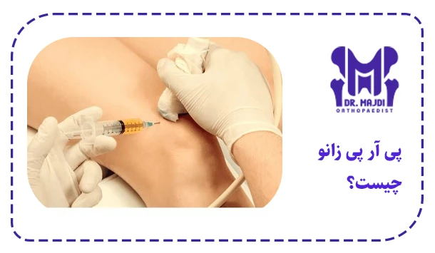 پی آر پی زانو چیست؟
