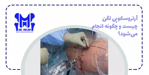 آرتروسکوپی لگن چیست و چگونه انجام می‌شود؟
