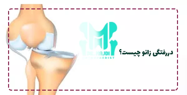 دررفتگی زانو چیست؟