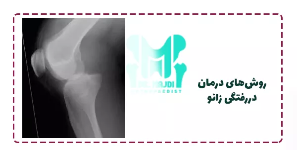روش‌های درمان دررفتگی زانو