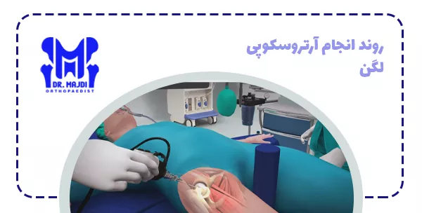 روند انجام آرتروسکوپی لگن