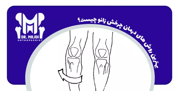 بهترین روش های درمان چرخش زانو چیست؟