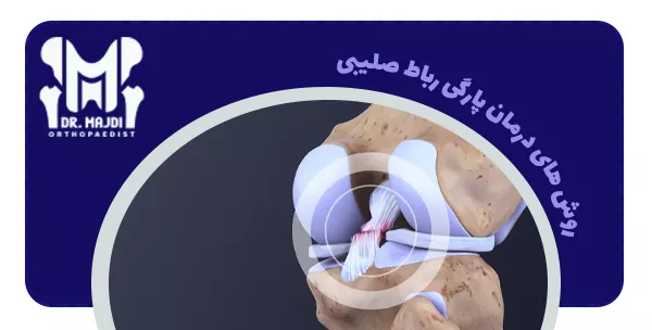 روش های درمان پارگی رباط صلیبی