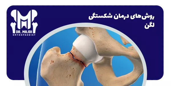 روش‌های درمان شکستگی لگن
