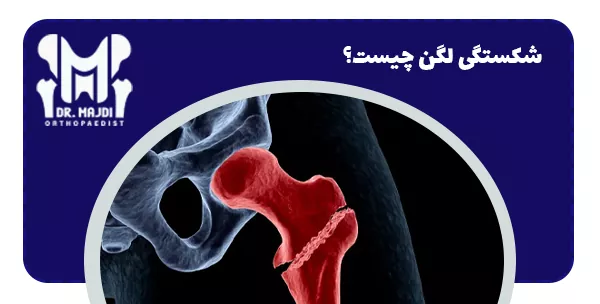 شکستگی لگن چیست؟