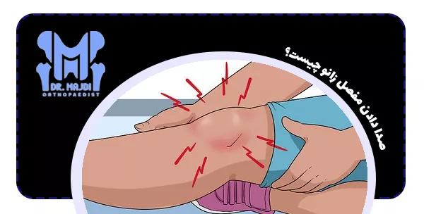 صدا دادن مفصل زانو چیست؟