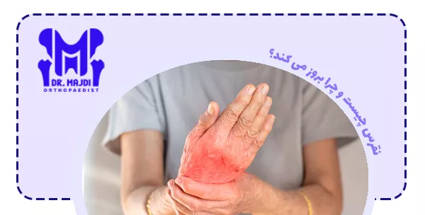 نقرس چیست و چرا بروز می کند؟
