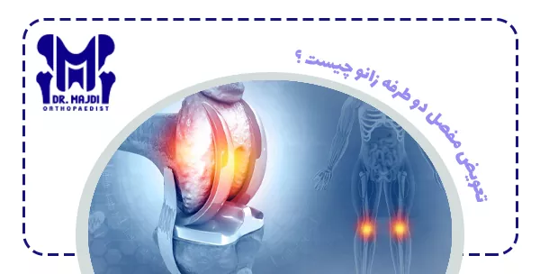 تعویض مفصل دو طرفه زانو چیست ؟