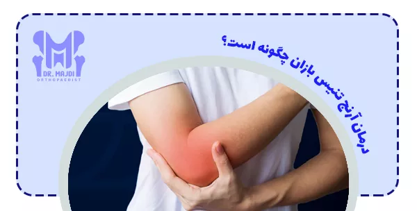 درمان آرنج تنیس بازان چگونه است؟