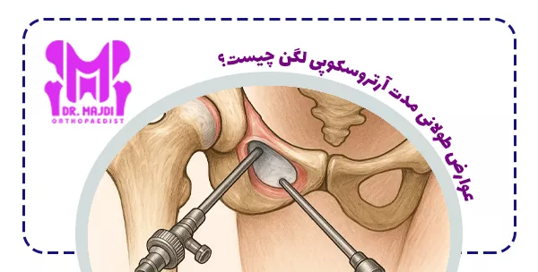 عوارض طولانی مدت آرتروسکوپی لگن چیست؟
