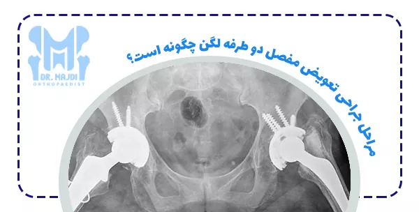 مراحل جراحی تعویض مفصل دو طرفه لگن چگونه است؟