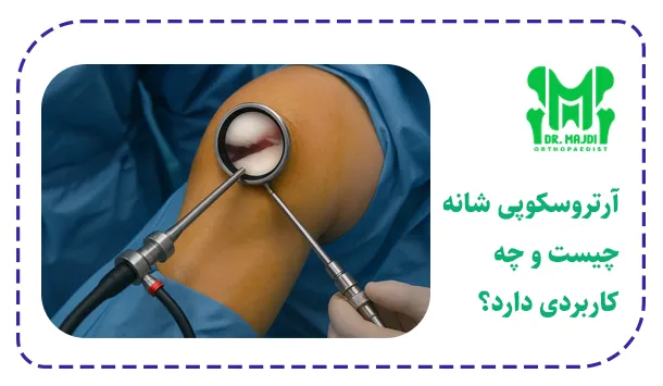 آرتروسکوپی شانه چیست و چه کاربردی دارد؟ آرتروسکوپی شانه چیست و چه کاربردی دارد؟