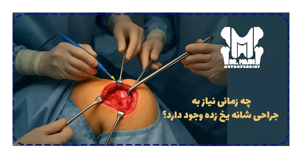 چه زمانی نیاز به جراحی شانه یخ زده وجود دارد؟ چه زمانی نیاز به جراحی شانه یخ زده وجود دارد؟