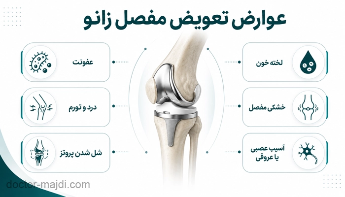 بعد از تعویض مفصل زانو چه عوارضی ممکن است رخ دهد؟
