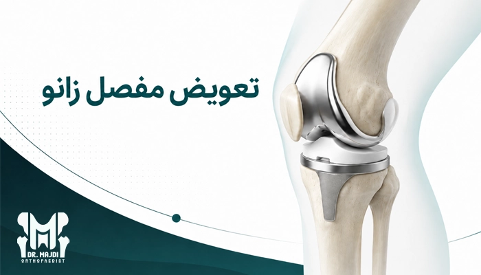 تعویض مفصل زانو